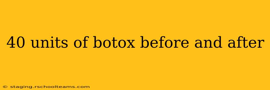 40 units of botox before and after