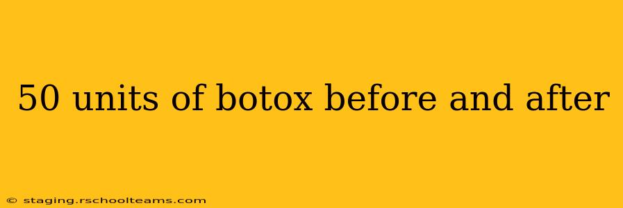 50 units of botox before and after