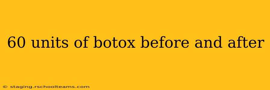 60 units of botox before and after