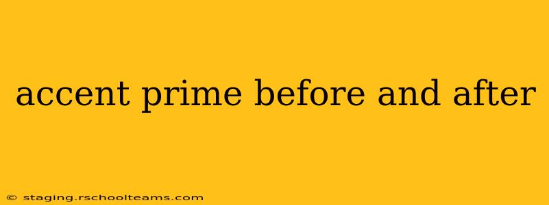 accent prime before and after
