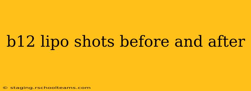 b12 lipo shots before and after