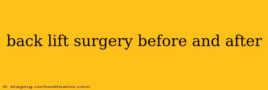 back lift surgery before and after