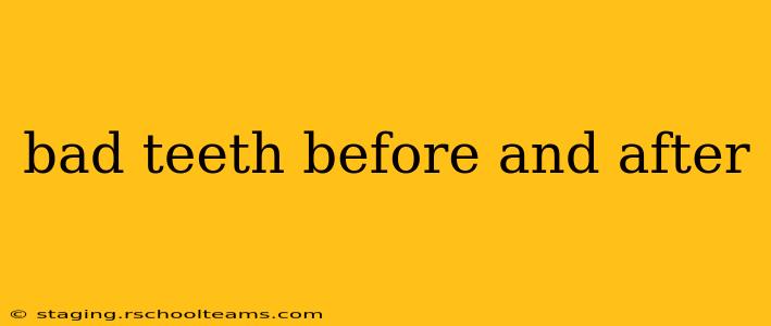 bad teeth before and after