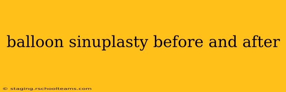 balloon sinuplasty before and after