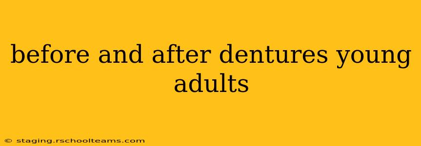 before and after dentures young adults