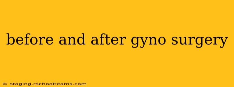 before and after gyno surgery