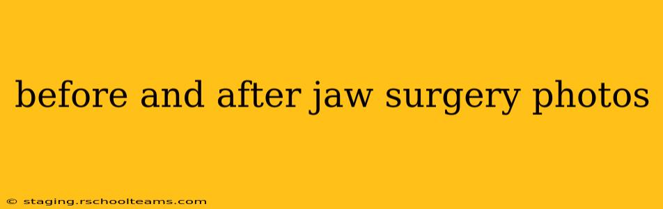 before and after jaw surgery photos