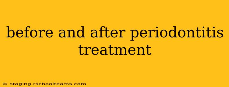 before and after periodontitis treatment