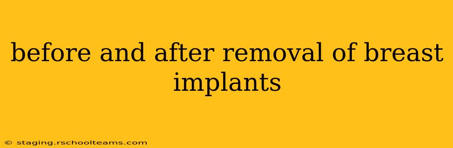 before and after removal of breast implants