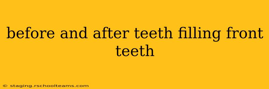 before and after teeth filling front teeth