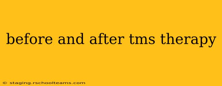 before and after tms therapy