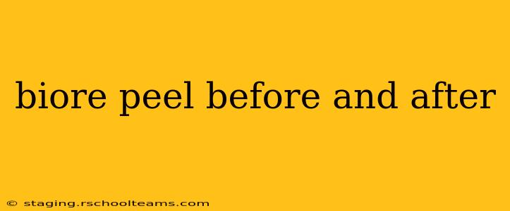 biore peel before and after