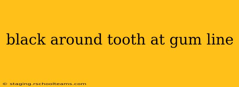 black around tooth at gum line