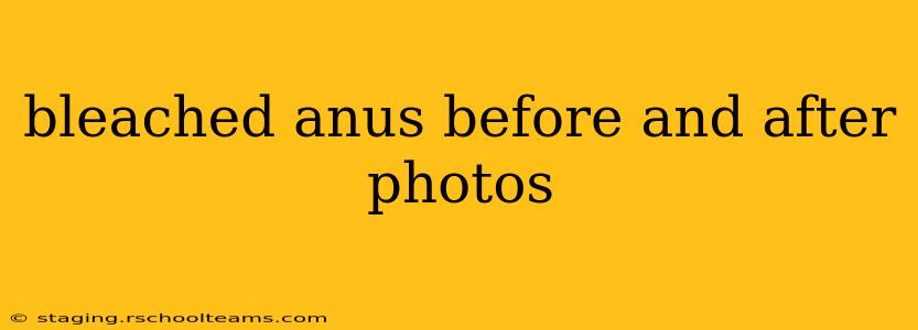 bleached anus before and after photos