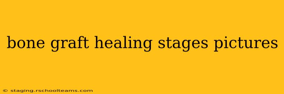 bone graft healing stages pictures