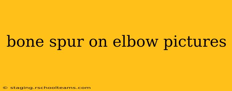 bone spur on elbow pictures