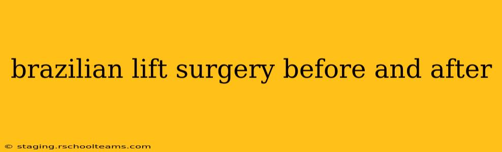 brazilian lift surgery before and after