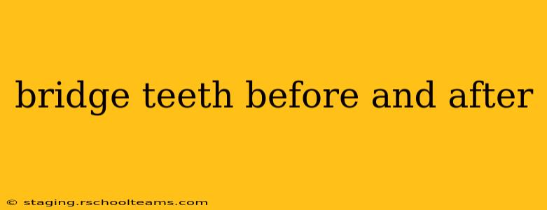 bridge teeth before and after