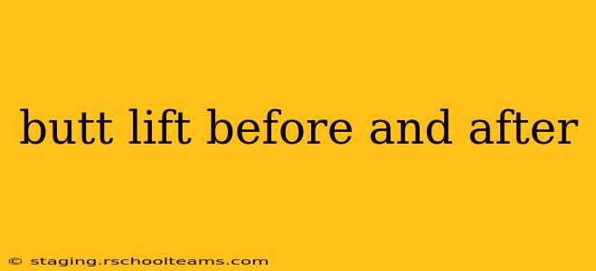 butt lift before and after