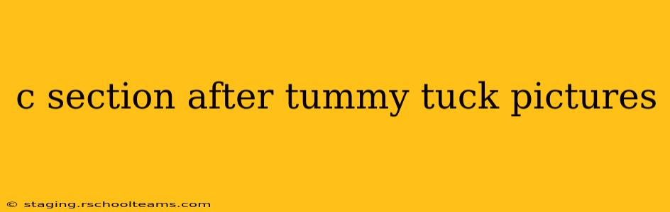 c section after tummy tuck pictures