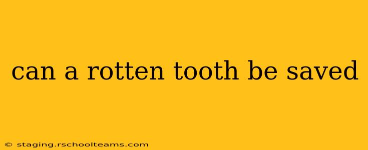 can a rotten tooth be saved