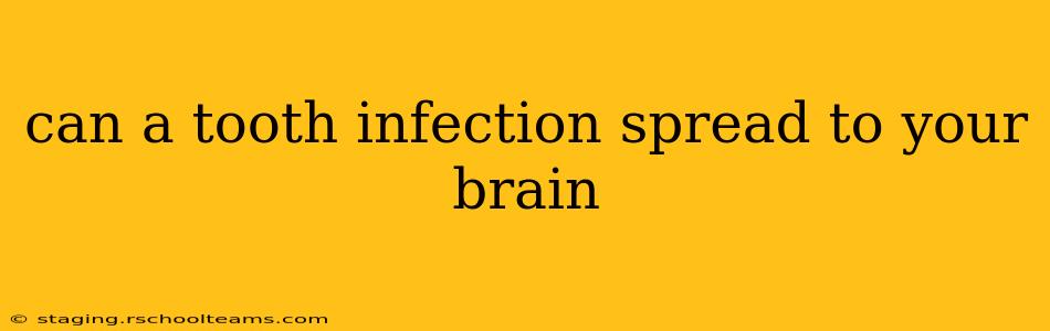 can a tooth infection spread to your brain