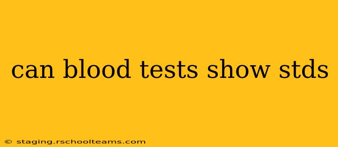 can blood tests show stds