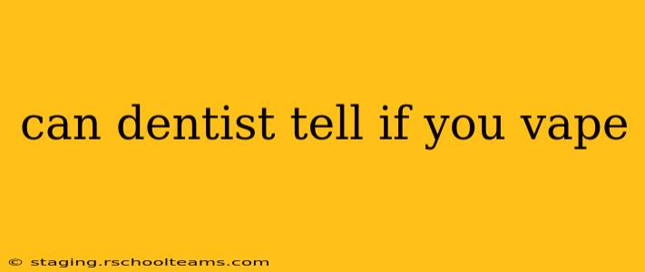 can dentist tell if you vape