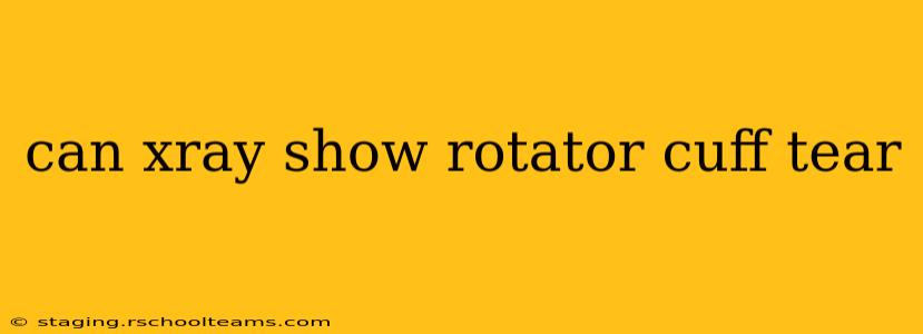 can xray show rotator cuff tear