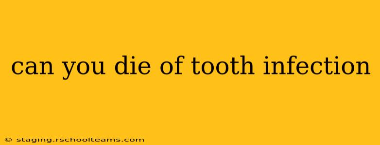 can you die of tooth infection