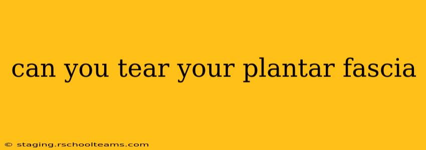 can you tear your plantar fascia