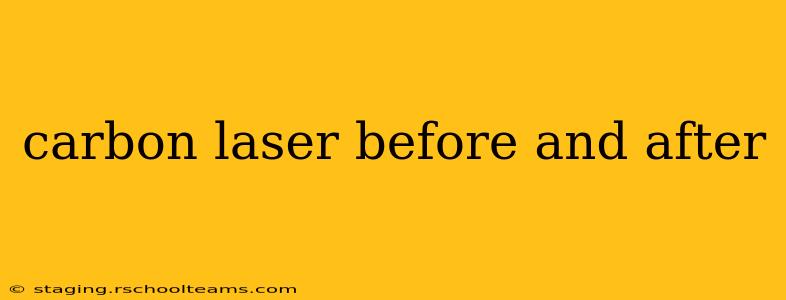 carbon laser before and after
