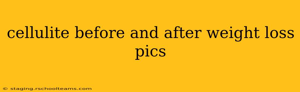 cellulite before and after weight loss pics