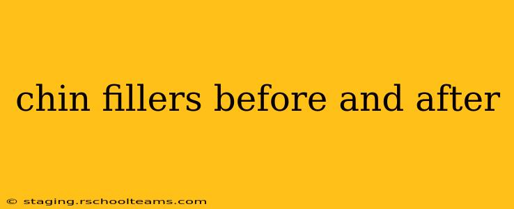 chin fillers before and after
