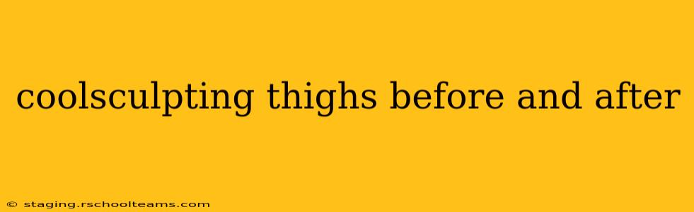 coolsculpting thighs before and after