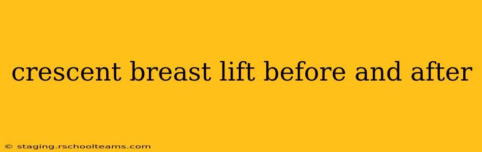 crescent breast lift before and after