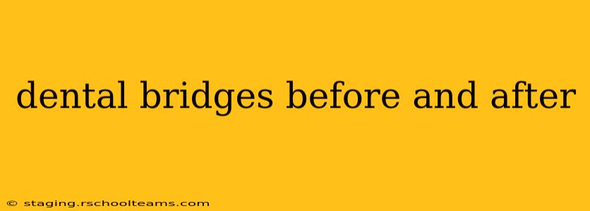 dental bridges before and after