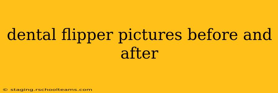 dental flipper pictures before and after