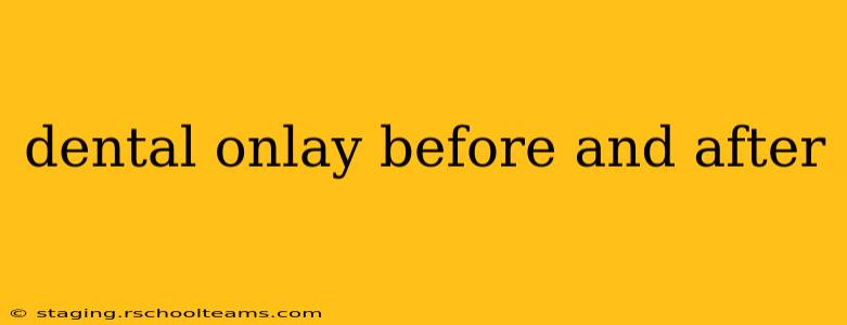 dental onlay before and after