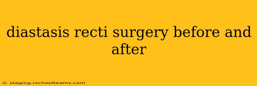 diastasis recti surgery before and after