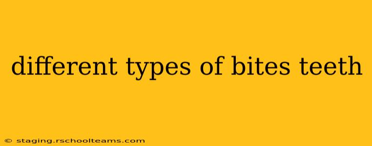 different types of bites teeth