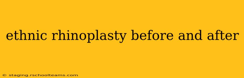 ethnic rhinoplasty before and after