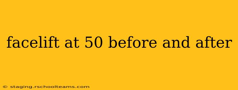 facelift at 50 before and after