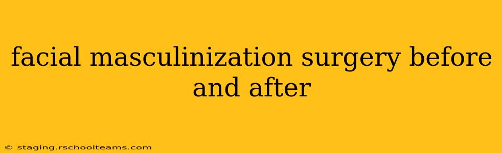 facial masculinization surgery before and after