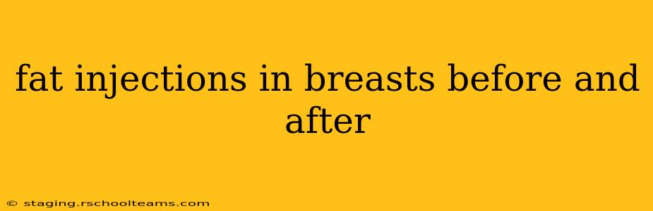 fat injections in breasts before and after