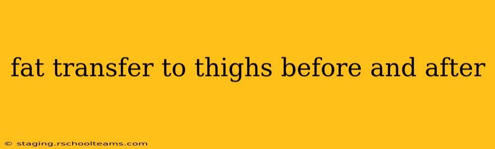 fat transfer to thighs before and after