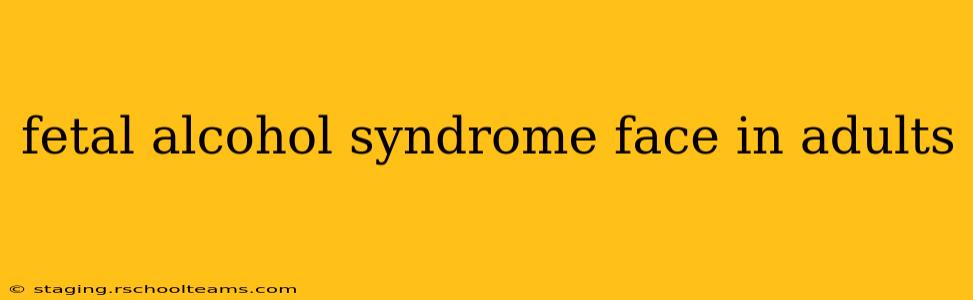 fetal alcohol syndrome face in adults