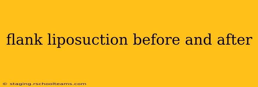 flank liposuction before and after