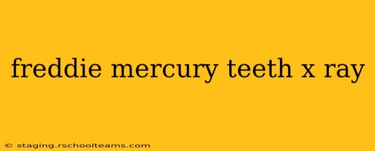 freddie mercury teeth x ray