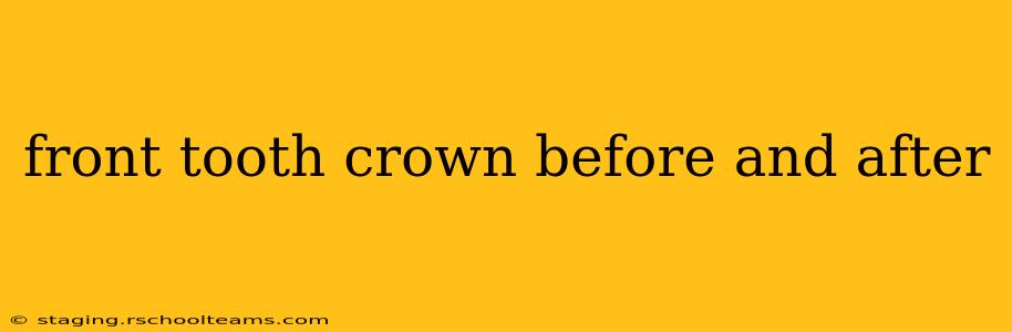 front tooth crown before and after